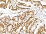 DCP2 Antibody in Immunohistochemistry (Paraffin) (IHC (P))