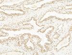 DCP2 Antibody in Immunohistochemistry (Paraffin) (IHC (P))