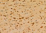 DDB1 Antibody in Immunohistochemistry (Paraffin) (IHC (P))