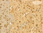 MCK10 Antibody in Immunohistochemistry (Paraffin) (IHC (P))