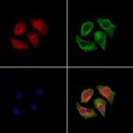 Dectin 1 Antibody in Immunocytochemistry (ICC/IF)