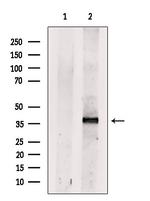 Dectin 1 Antibody in Western Blot (WB)