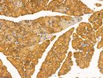 Desmin Antibody in Immunohistochemistry (Paraffin) (IHC (P))