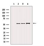 Desmin Antibody in Western Blot (WB)