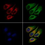 DHCR7 Antibody in Immunocytochemistry (ICC/IF)