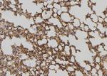 DHRS4 Antibody in Immunohistochemistry (Paraffin) (IHC (P))