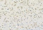 DHX9 Antibody in Immunohistochemistry (Paraffin) (IHC (P))