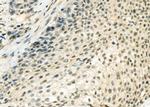 DHX9 Antibody in Immunohistochemistry (Paraffin) (IHC (P))