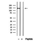 DHX9 Antibody in Western Blot (WB)