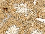 DIAPH3 Antibody in Immunohistochemistry (Paraffin) (IHC (P))