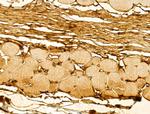 DIAPH3 Antibody in Immunohistochemistry (Paraffin) (IHC (P))