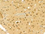 RNA pol II CTD Antibody in Immunohistochemistry (Paraffin) (IHC (P))