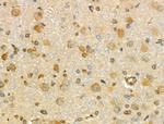 RNA pol II CTD Antibody in Immunohistochemistry (Paraffin) (IHC (P))