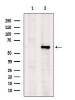 DOK7 Antibody in Western Blot (WB)