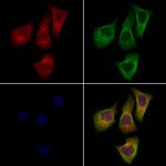 DPP6 Antibody in Immunocytochemistry (ICC/IF)