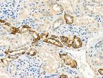 DVL3 Antibody in Immunohistochemistry (Paraffin) (IHC (P))