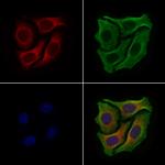 DYNC1H1 Antibody in Immunocytochemistry (ICC/IF)