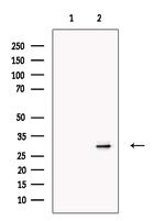 Prodynorphin Antibody in Western Blot (WB)