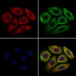 GLT-1 Antibody in Immunocytochemistry (ICC/IF)