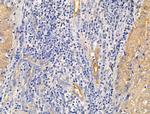 ECM2 Antibody in Immunohistochemistry (Paraffin) (IHC (P))