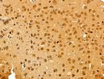 ECSIT Antibody in Immunohistochemistry (Paraffin) (IHC (P))