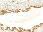 ECSIT Antibody in Immunohistochemistry (Paraffin) (IHC (P))