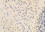 EEF1B2 Antibody in Immunohistochemistry (Paraffin) (IHC (P))