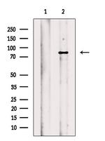 EEF2K Antibody in Western Blot (WB)