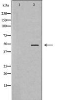 eIF4A1 Antibody in Western Blot (WB)