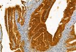 eIF4A3 Antibody in Immunohistochemistry (Paraffin) (IHC (P))