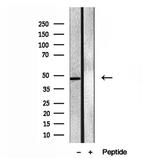 eIF4A3 Antibody in Western Blot (WB)