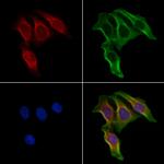 ELOVL5 Antibody in Immunocytochemistry (ICC/IF)