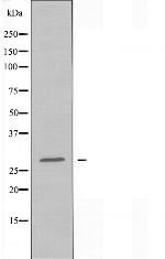 ELOVL5 Antibody in Western Blot (WB)