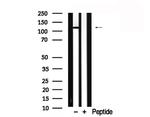 EPHA3 Antibody in Western Blot (WB)