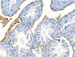 EphB2 Antibody in Immunohistochemistry (Paraffin) (IHC (P))