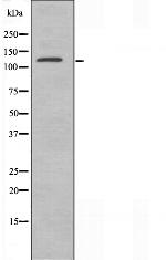 XPG Antibody in Western Blot (WB)