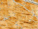 ERLIN2 Antibody in Immunohistochemistry (Paraffin) (IHC (P))