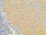 ERLIN2 Antibody in Immunohistochemistry (Paraffin) (IHC (P))