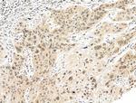 ESD Antibody in Immunohistochemistry (Paraffin) (IHC (P))