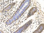 ESD Antibody in Immunohistochemistry (Paraffin) (IHC (P))