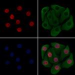 XPO5 Antibody in Immunocytochemistry (ICC/IF)