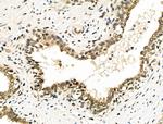 EZH1 Antibody in Immunohistochemistry (Paraffin) (IHC (P))