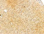 FARSB Antibody in Immunohistochemistry (Paraffin) (IHC (P))