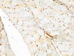 FARSB Antibody in Immunohistochemistry (Paraffin) (IHC (P))