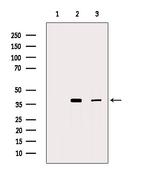 FAS (CD95) Antibody in Western Blot (WB)