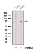 SLC27A4 Antibody in Western Blot (WB)