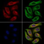 FDXR Antibody in Immunocytochemistry (ICC/IF)