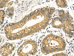 FGF1 Antibody in Immunohistochemistry (Paraffin) (IHC (P))