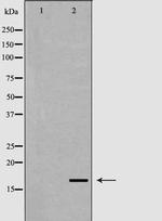 FGF1 Antibody in Western Blot (WB)