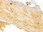 FHL2 Antibody in Immunohistochemistry (Paraffin) (IHC (P))